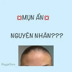 Bài viết Maggie