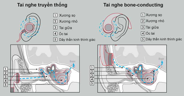 bonephones-illustration-2.jpg