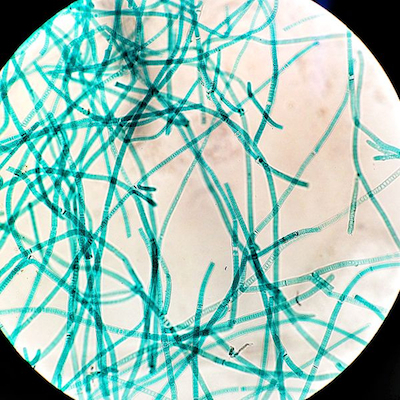 2289246_cyanobacteria.jpg