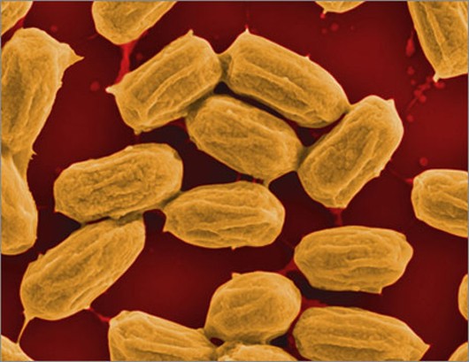 bacillus-subtilis.jpg