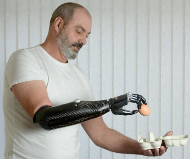 Tinhte_robotic-bionic-prosthetic-arm.jpg
