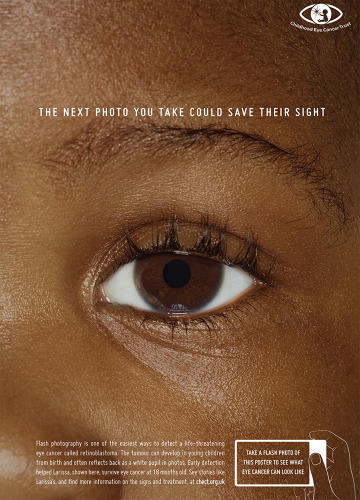3039513-slide-s-4-eye-cancer-poster.jpg