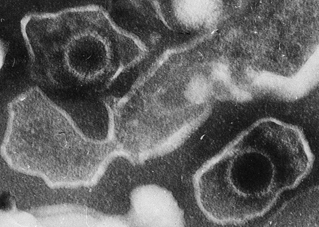 Tinhte-Epstein_Barr_Virus_virions.jpg