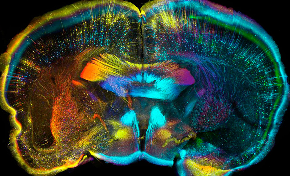 2-mouse-brain-scan.jpg