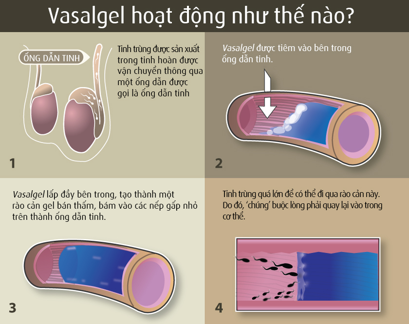 Vasalgel-Infographic_tinhte.jpg