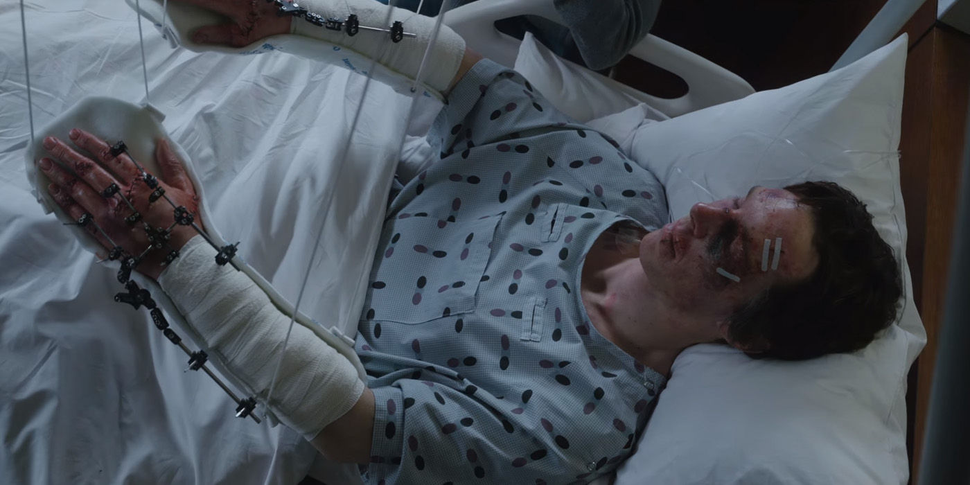 Doctor-Strange-Teaser-Trailer-Hand-Surgery.jpg