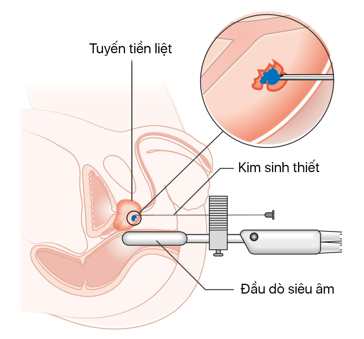 sinh-thiet-tinhte.jpg