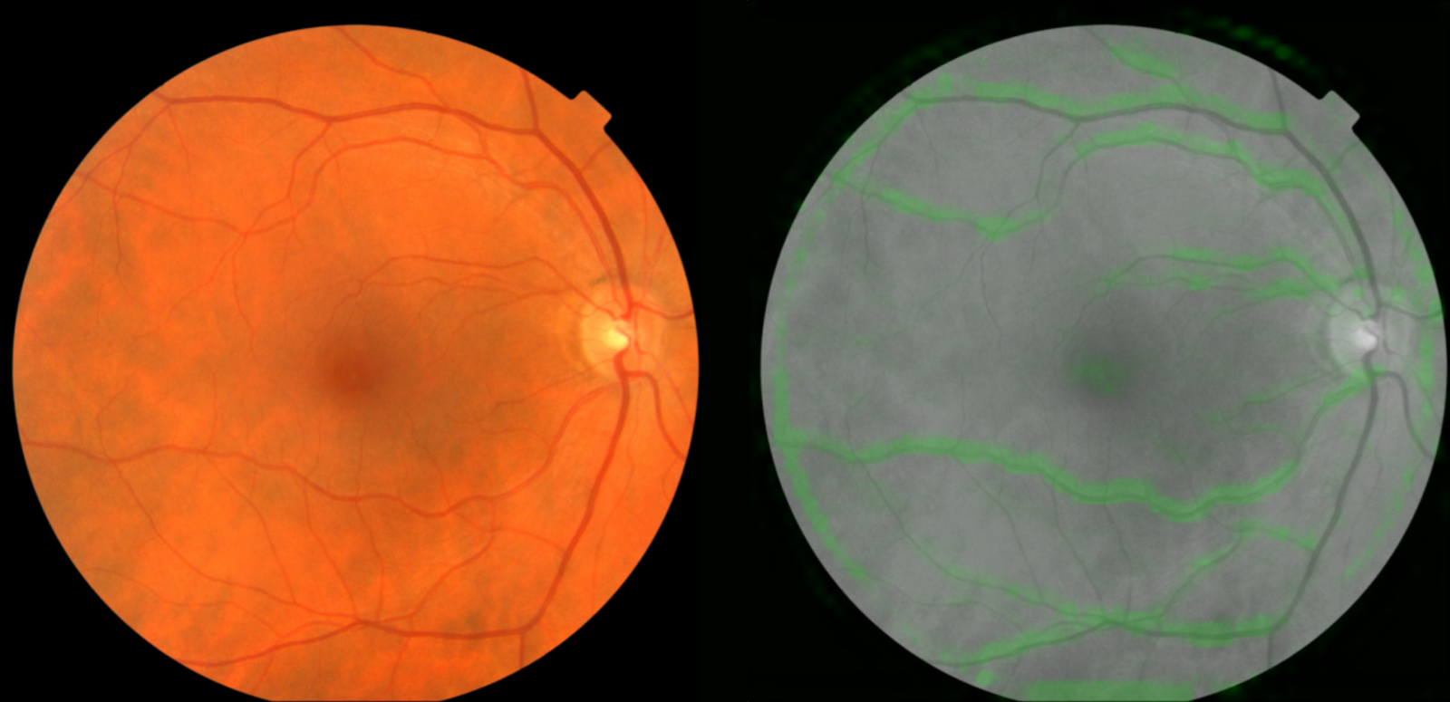 fundus_images.png