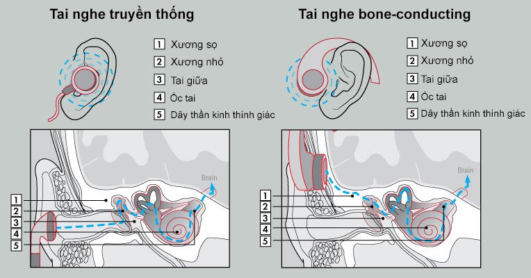 3259067_bonephones-illustration-2.jpg