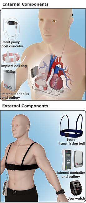 CET-system.jpg