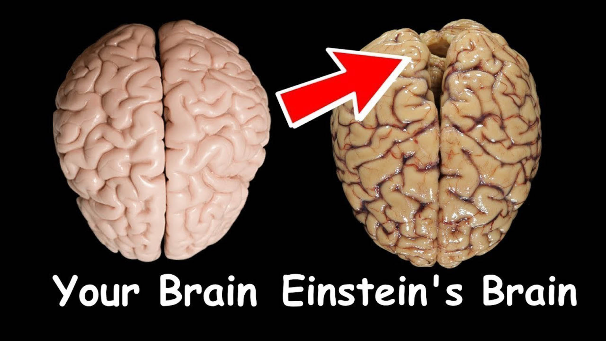 He is a brain. Мозг Эйнштейна.