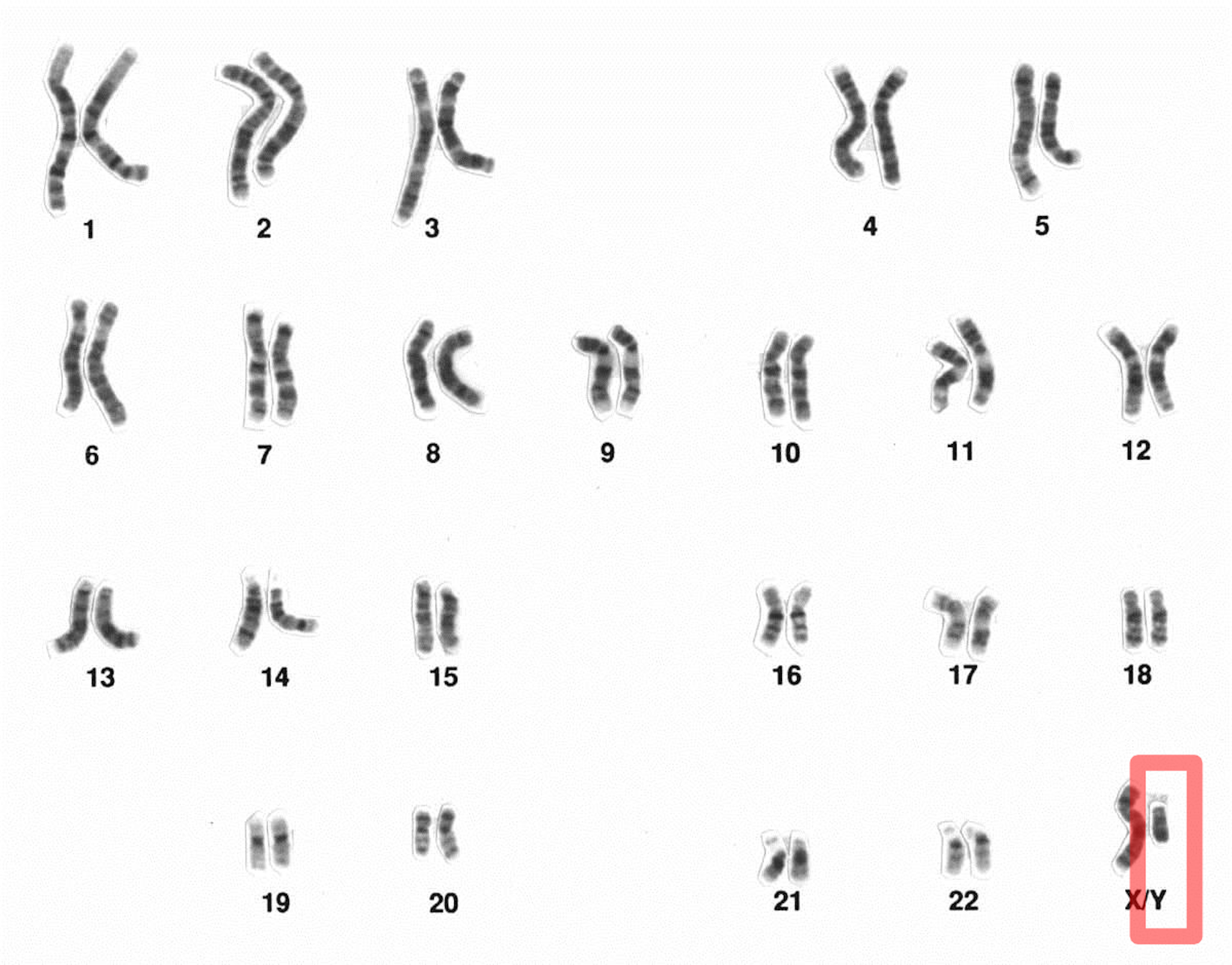 y-chromosome-4.png